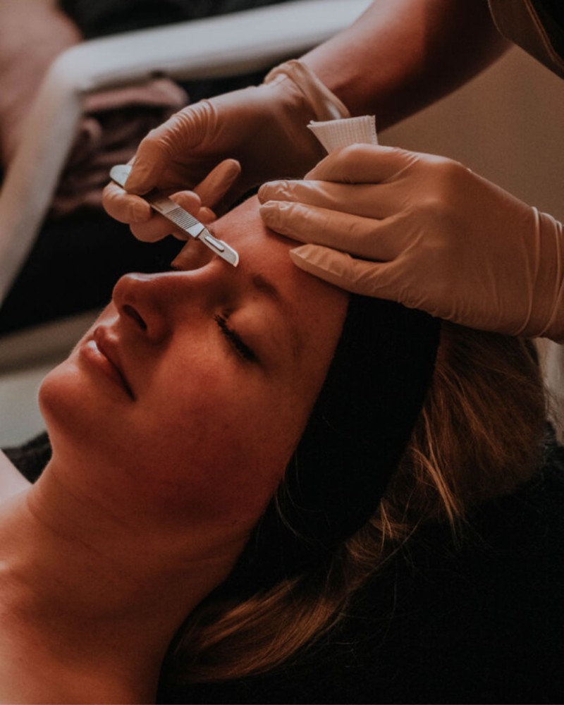 DERMAPLANING